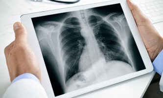 Digital radiography (DR)